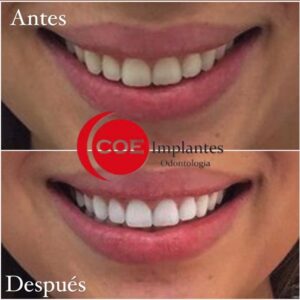 Somos un equipo con profesionales altamente capacitados para realizar este tipo de tratamientos,