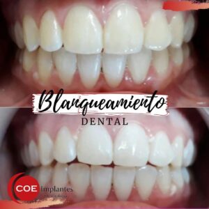 Somos un equipo de profesionales altamente capacitados para realizar este tipo de tratamientos,