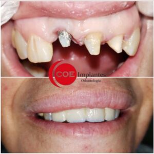 Somos un equipo de profesionales altamente capacitados para realizar este tipo de tratamientos, (1)